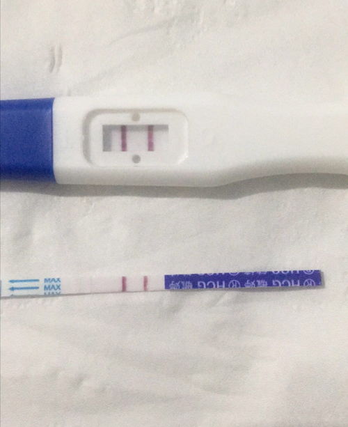 40歲還可以通過試管嬰兒生寶寶嗎？權(quán)威解答與注意事項